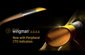 reflow-medical-wingman-catheter