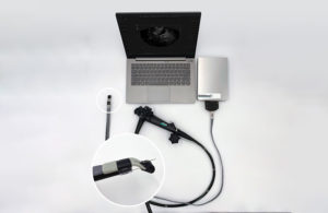 EndoSound Vision System endoscope ultrasound