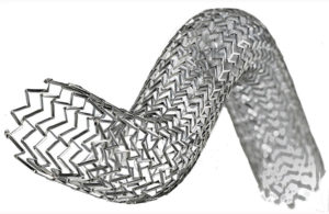 The Vesper DUO Venous Stent System Philips