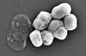 A.baumannii bacteria that can develop in catheters