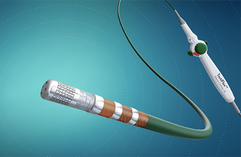 This Abbott marketing illustration shows its TactiFlex Ablation Catheter, Sensor Enabled for treating AFib.