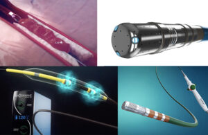 This collage of four images of 2023 catheter innovations includes Penumbra's Lightning Flash mechanical thrombectomy system for removing blood clots, Biosense Webster's QDOT Micro catheter for treating AFib, Abbott's TactiFlex Ablation Catheter, Sensor Enabled, and Shockwave Medical's C2+ coronary intravascular lithotripsy (IVL) catheter.