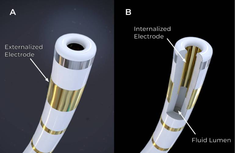 Field Medical FieldForce Catheter Tip (1)