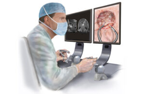 An illustration of a neurosurgeon using a robotic endoscope to remove a brain tumor.