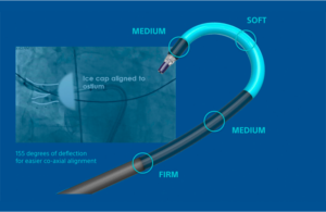 This is a Boston Scientific marketing image of its PolarSheath catheter-based delivery system.