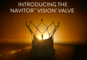Abbott Navitor Vision TAVI launch video