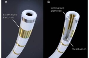 Field Medical FieldForce Catheter for pulsed field ablation (PFA)