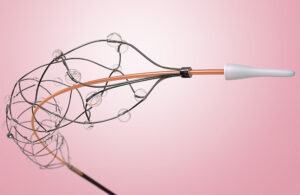 An illustration showing Flow Medical's novel delivery scaffold and its hollow nitinol tubing.