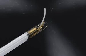 Francis-Medical-water-vapor-ablation-therapy