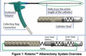 BD Bard Rotarex Atherectomy System image FDA (1)