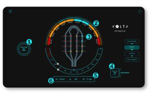 Volta Medical Volta AF-Xplorer