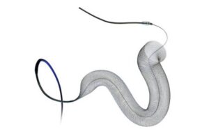 Medtronic pipeline vantage embolization device (1)
