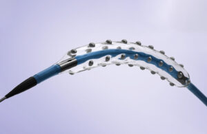 An illustration of Elixir Medical's LithiX catheter.