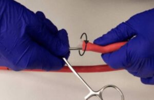 BD esophagogastric tube recall (1)