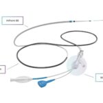 Route 92 Medical HiPoint 88 reperfusion system
