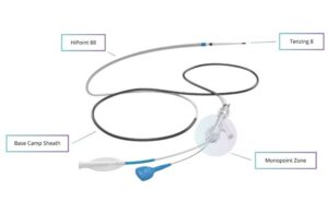 Route 92 Medical HiPoint 88 reperfusion system