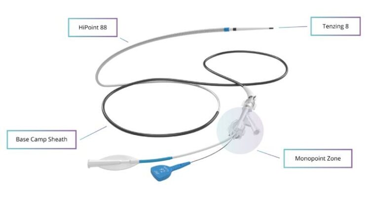 Real-world data backs Route 92 reperfusion system