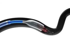 Anaconda Biomed ANA5 funnel catheter in vessel (1)