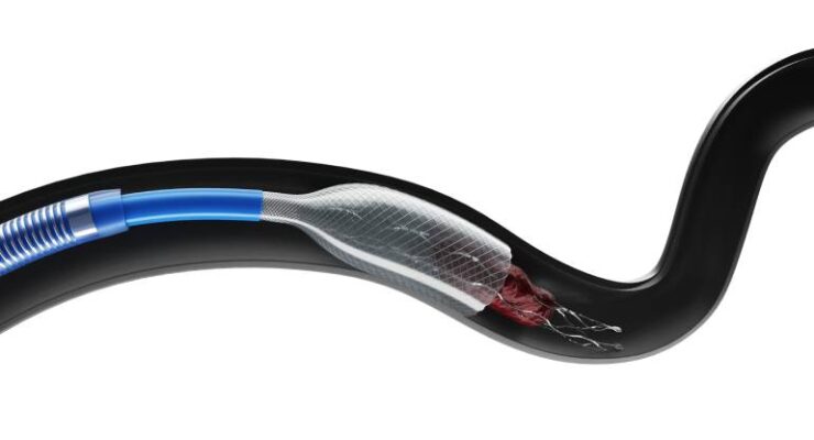 Anaconda Biomed brings in $56 million