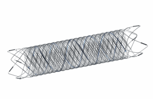 Terumo Neuro's FredX neurovascular stent