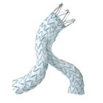 The Endurant stent graft system. [Image courtesy of Medtronic]