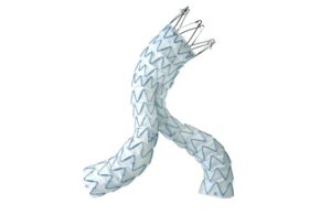 The Endurant stent graft system. [Image courtesy of Medtronic]