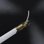 This is a Francis Medical marketing image of the distal end of its Vanquish water vapor ablation system.