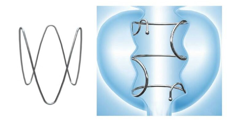 ProVerum, Zenflow win FDA nods for BPH treatment devices