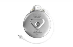 Portal Diabetes Portal Pump implantable insulin pump