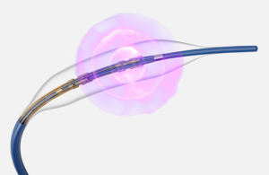 Boston Scientific Seismiq 4CE Coronary Intravascular Lithotripsy IVL catheter