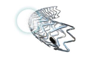 Teleflex Biotronik Freesolve resorbable magnesium scaffold