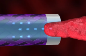 RapidPulse thrombectomy aspiration system