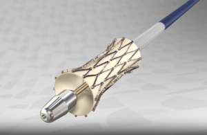 enVVeno Medical enVVE transcatheter venous valve