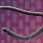 This is a Corcym marketing image of its TriMemo implant for tricuspid valve repair.