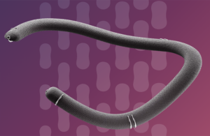 This is a Corcym marketing image of its TriMemo implant for tricuspid valve repair.