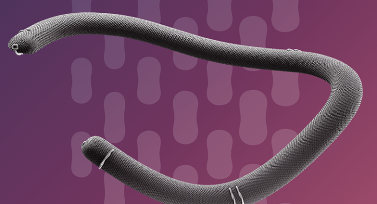 Corcym achieves first-in-human implant of TriMemo for tricuspid valve repair