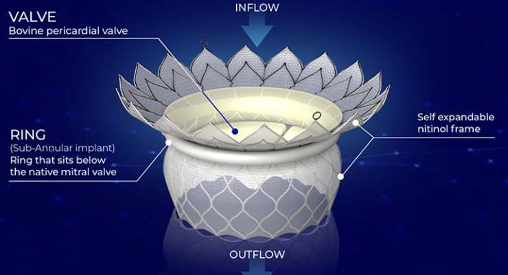 HighLife raises more than $90M to advance its TMVR system