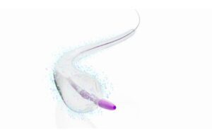 Medtronic In.Pact 018 drug-coated balloon catheter