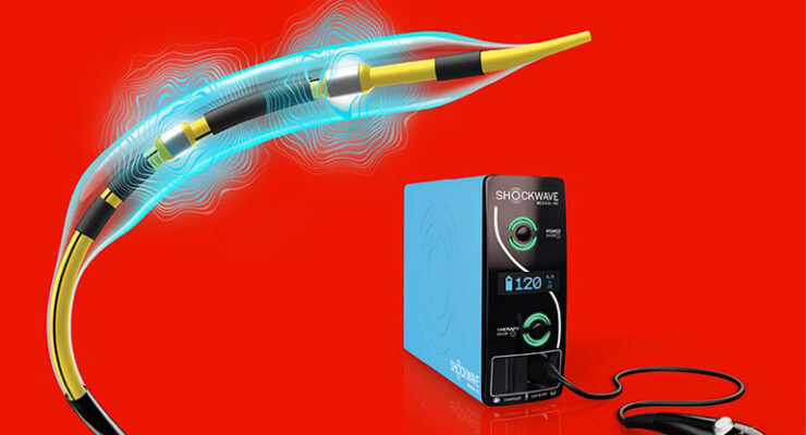 J&J launches faster Shockwave coronary catheter in the US