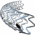 The Teleflex Freesolve RMS (resorbable magnesium scaffold).