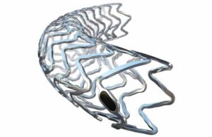 The Teleflex Freesolve RMS (resorbable magnesium scaffold).