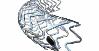 The Teleflex Freesolve RMS (resorbable magnesium scaffold).